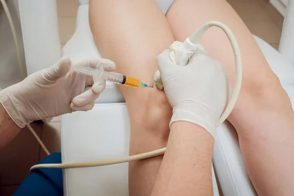 Intra-Articular Injections under Ultrasound Control